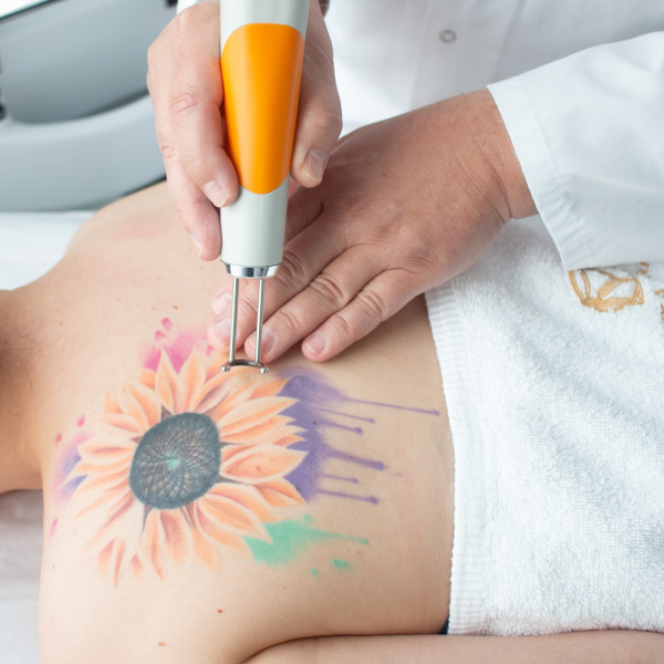 Discovery Pico Quanta – Laserowe usuwanie tatuażu i makijażu permanentnego