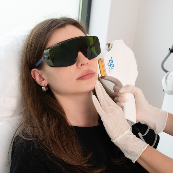 BBL HEROic – Laserowe leczenie trądziku różowatego