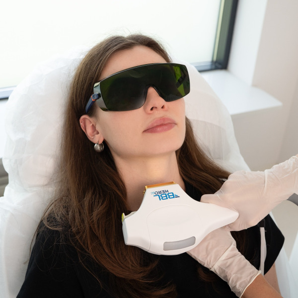 BBL HEROic Forever Clear – Laserowe leczenie trądziku pospolitego