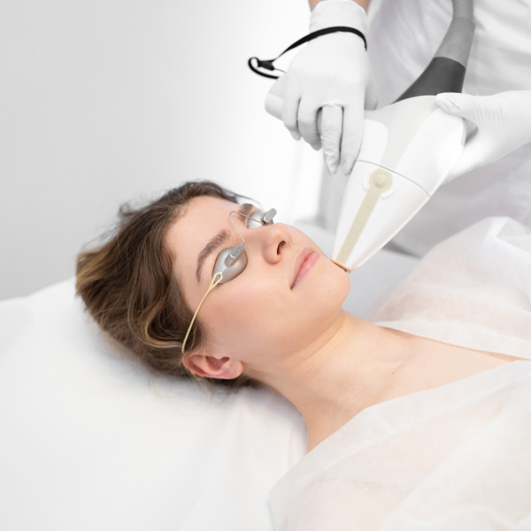 Vectus Cynosure – Depilacja Laserowa twarzy