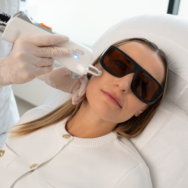 Derma V Lutronic – Laserowe leczenie trądziku różowatego