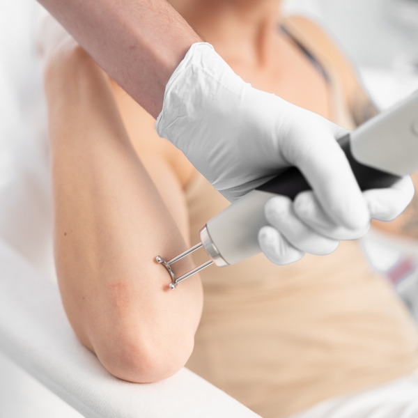 Discovery Pico Plus Quanta – Laserowe usuwanie blizn i rozstępów