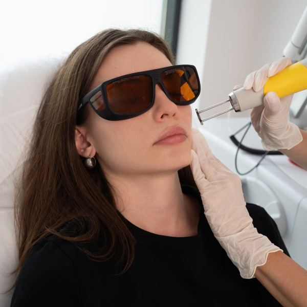 Discovery Pico Quanta – Laserowe leczenie przebarwień