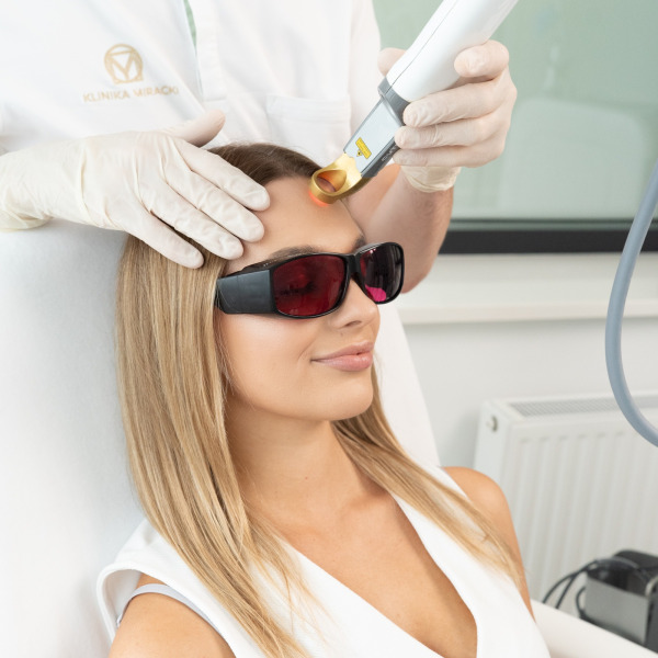 Excel V Cutera – Laserowe leczenie zmian naczyniowych