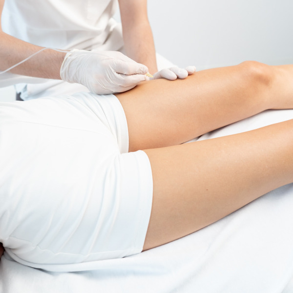 Karboksyterapia Venusian Co2 Therapy – Usuwanie blizn i rozstępów