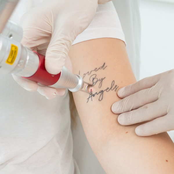 Pico Plus Lutronic – Laserowe usuwanie tatuażu i makijażu permanentnego