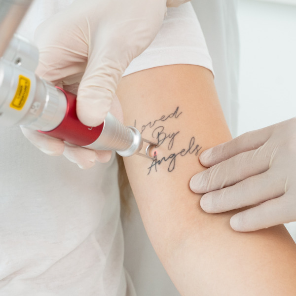 Pico Plus Lutronic &ndash; Laserowe usuwanie tatuażu i makijażu permanentnego