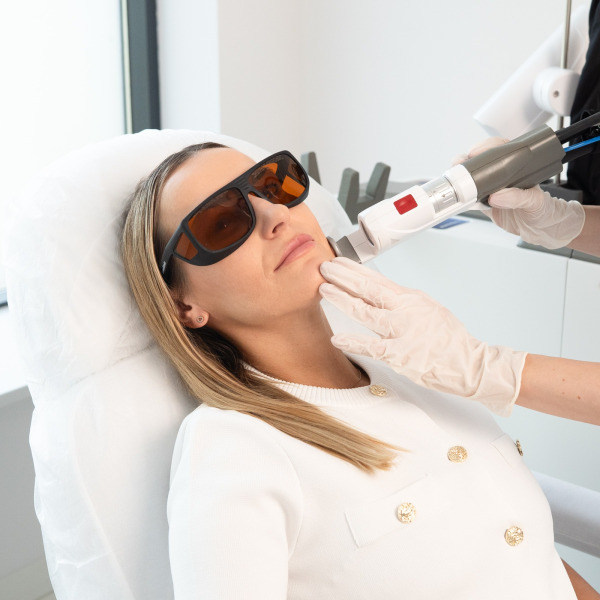 Suprema Quanta – Laserowe leczenie trądziku różowatego