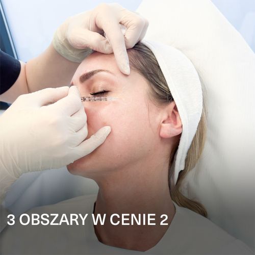 Nowość! Redukcja zmarszczek mimicznych PREMIUM Relfydess PEARL Technology – 3 obszary w cenie 2