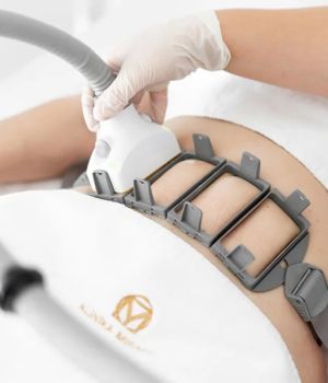 Laser SculpSure