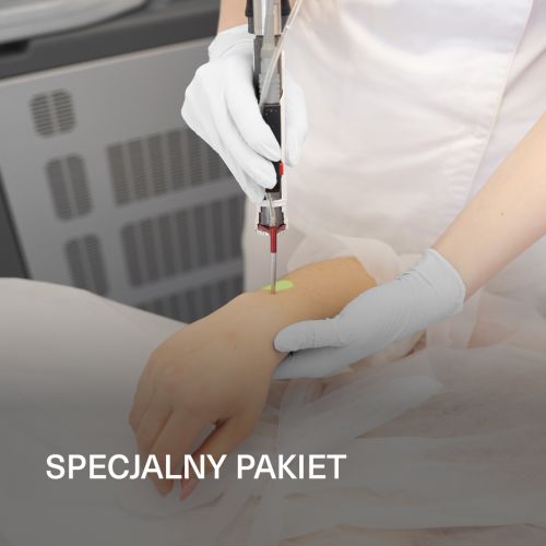 MOTUS DEKA – Całe ręce (ramiona + przedramiona) GRATIS palce dłoni MOTUS DEKA – Całe ręce (ramiona + przedramiona) GRATIS palce dłoni