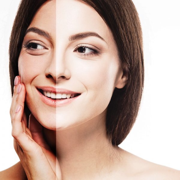 mikrodermabrazja-hydrafacial-wybielanie-klinika-miracki-warszawa.jpg Odmładzanie i ujędrnianie twarzy efekty Warszawa