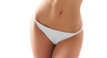 Depilacja bikini laserem – na czym polega zabieg?
